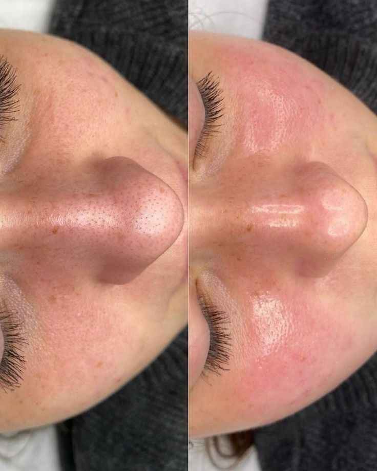 Dr Althea baume nettoyant purifiant