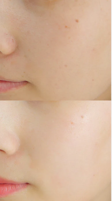 Dr Althea Essential Skin Conditioner Silk Mask 02 SkinGlow