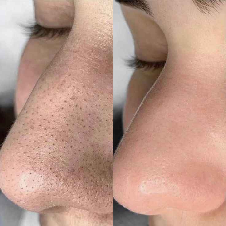 Beauty of Joseon – Eau de haricots rouges gel