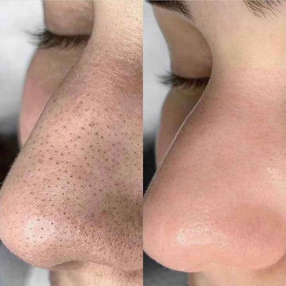 Beauty of Joseon – Eau de haricots rouges gel