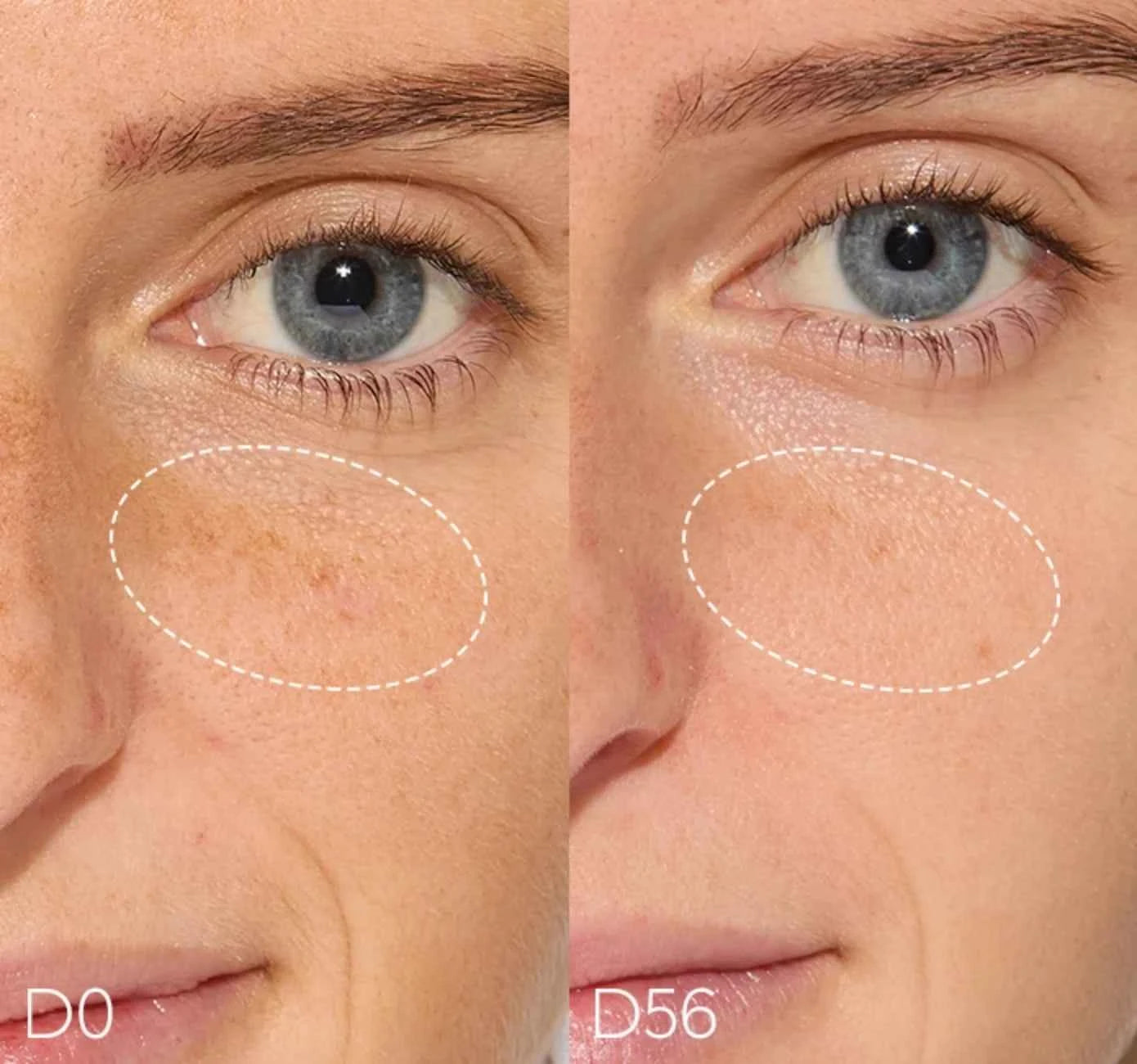 Haruharu Wonder – Sérum Centella 4% TXA Dark Spot Go Away