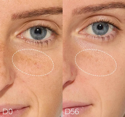 Haruharu Wonder – Sérum Centella 4% TXA Dark Spot Go Away