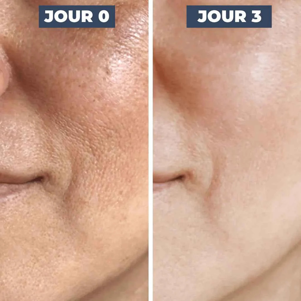 Haruharu Wonder - Black Rice Probiotics Barrier Essence