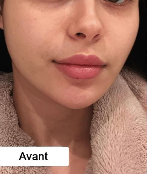 Avant