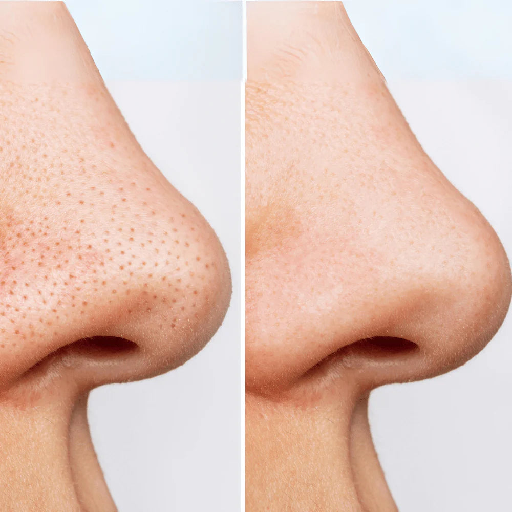 Anua Heartleaf Pore Clay pack SkinGlow