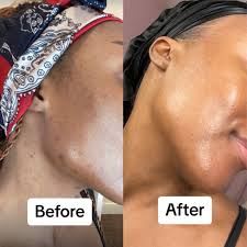 Tirtir - skin milk Toner SkinGlow