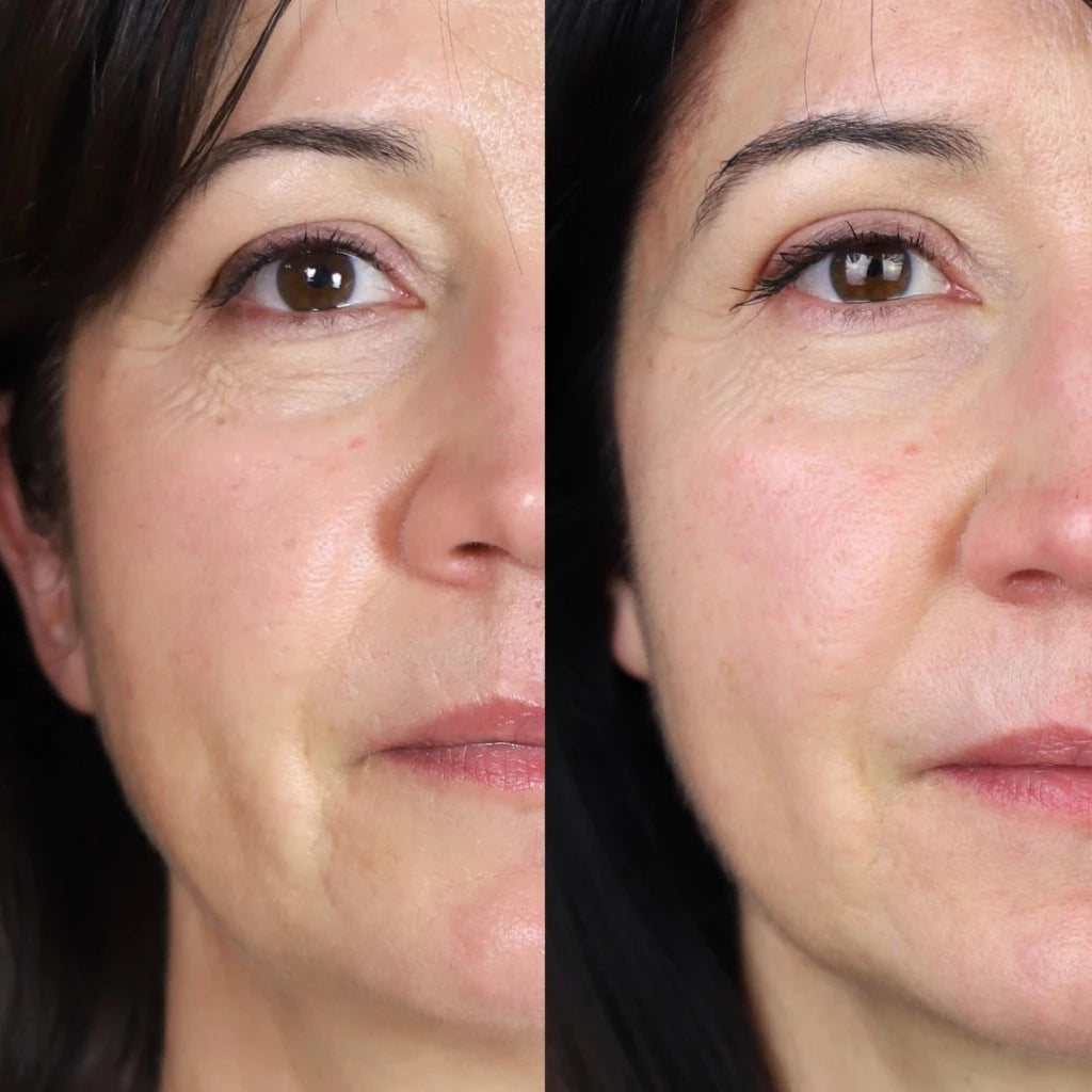 Medicube - Masque de Nuit Hydratant SkinGlow