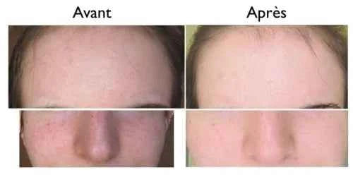 Haruharu Wonder – Crème solaire minérale pure au riz noir SPF50+ PA++++