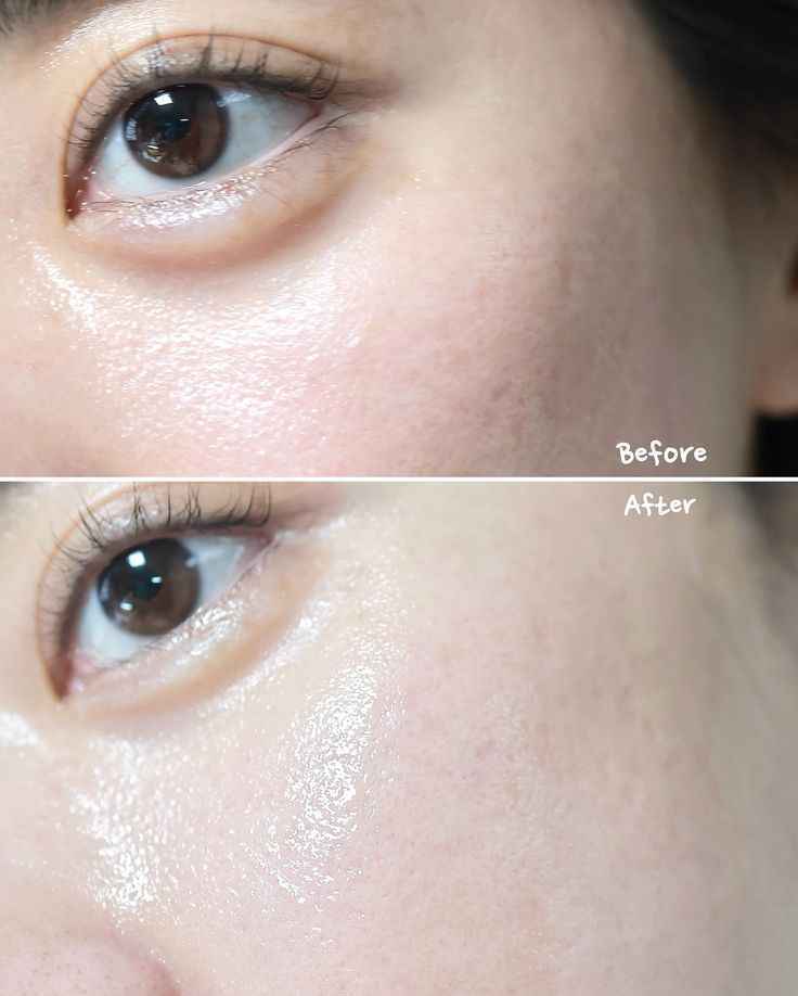 Beauté de Joseon – Lotion tonique rafraîchissante à la prune verte : AHA + BHA