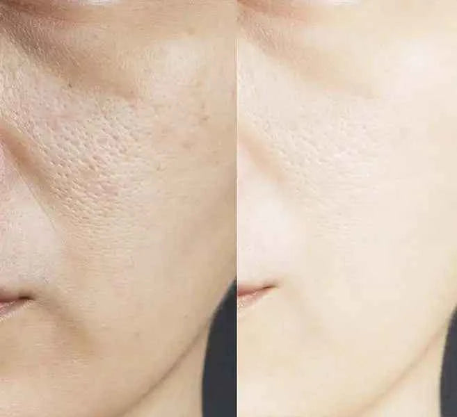 torriden – Essence longue tenue